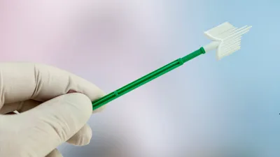 Cytologia płynna LBC