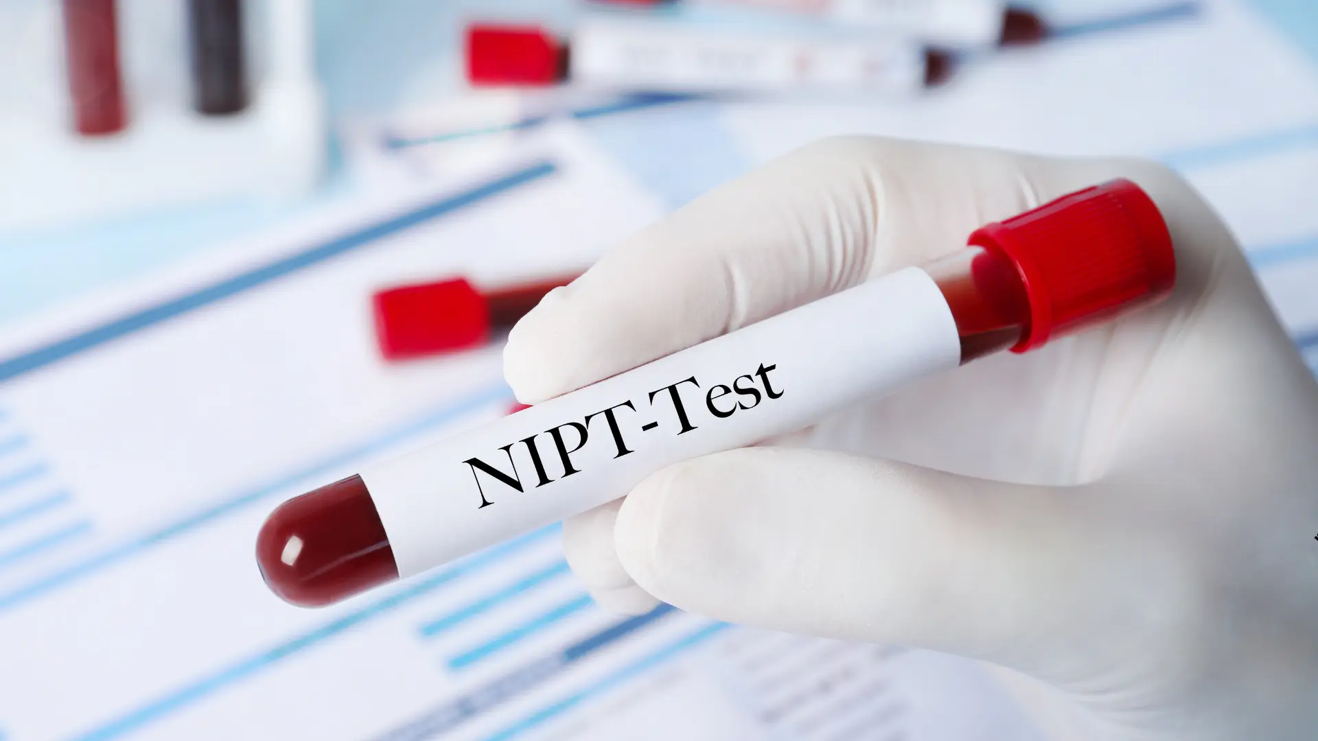 Nieinwazyjne Testy Prenatalne NIPT w CM Femmemedica