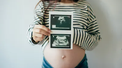 USG prenatalne I trymestr (11-14 tydzień ciąży)